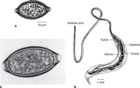 54 Intestinal Nematodes Basicmedical Key