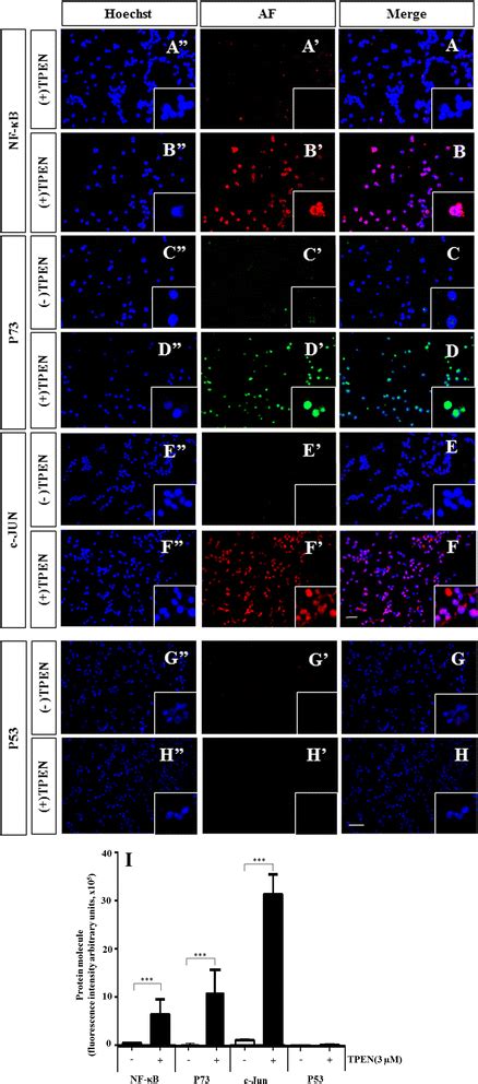 Tpen Induces The Differential Activation Of Transcription Factors In Download Scientific