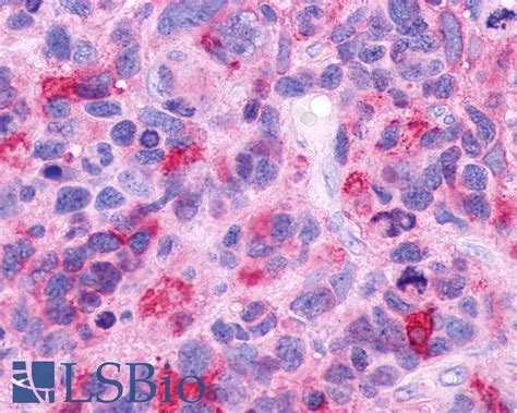 Pathplus Gpr Polyclonal Antibody Rabbit Anti Human Ihc Lsbio