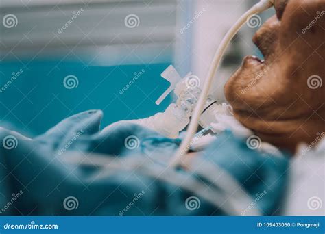 Patient Do Tracheostomy And Ventilator In Hospital Editorial Image