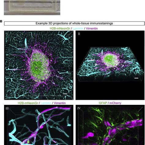 Whole Mount Immunostaining And Tissue Clearing Of Ex Vivo Organotypic