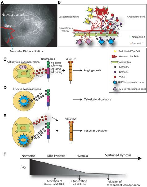 Neuronal Influence In Retinal Ischemic Disease In Ischemic