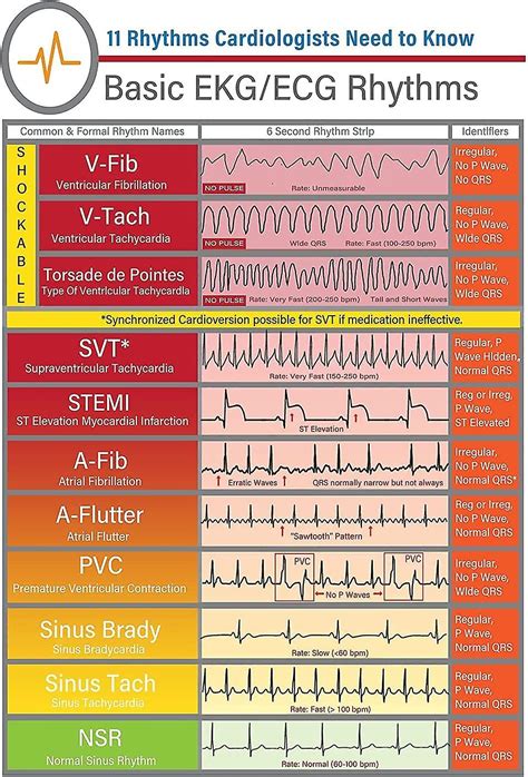 Rhythm Strip Interpretation