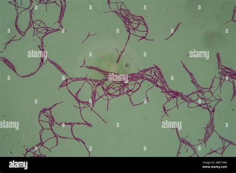 Bacillus Anthracis Anthrax Under The Microscope 200x Stock Photo Alamy