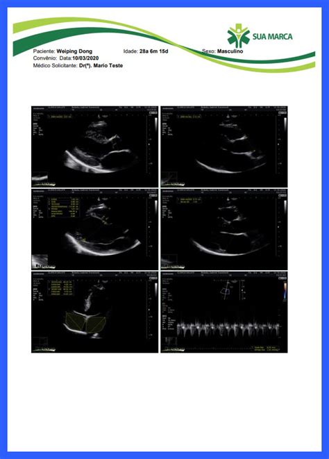 Ls Laudo De Ecocardiograma Lucas Solutions