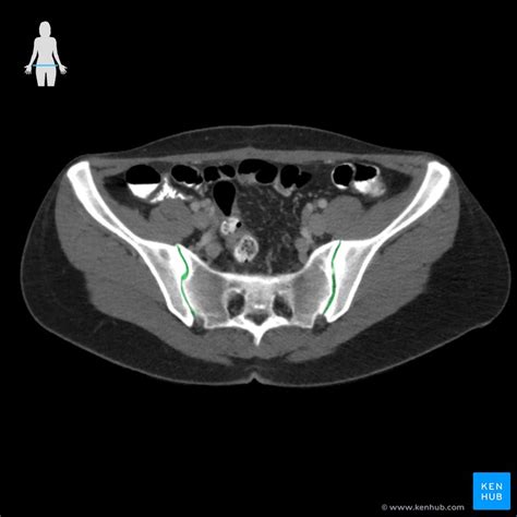 Sacroiliac Joint Anatomy And Ligaments Kenhub