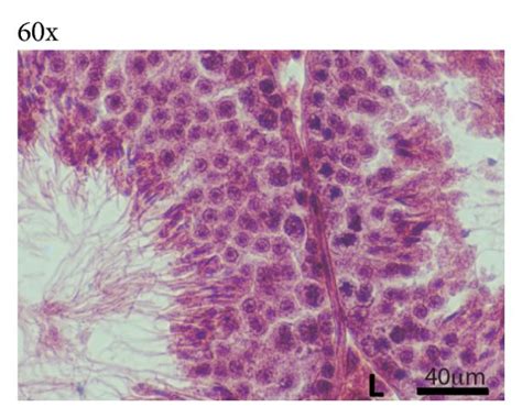 Morphological Analysis Of Mouse Testis After Different Postfixative