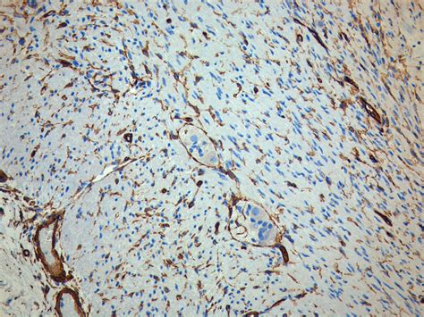 CD34 – Antibody Lexicon