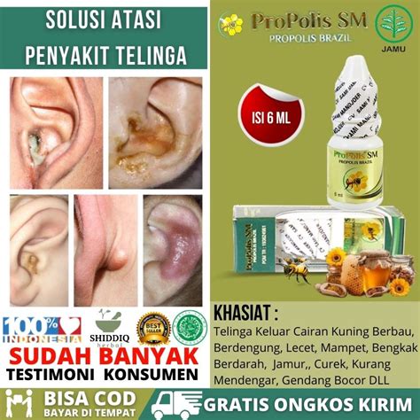 Obat Tetes Khusus Telinga Berair Dan Bau Anak Dan Dewasa Obat Alami