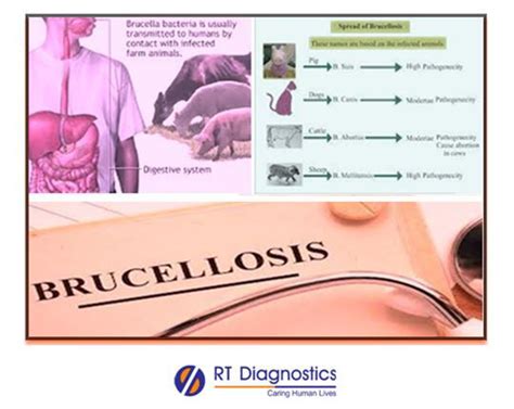 Brucella Test RT Diagnostics