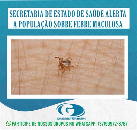 Secretaria De Estado De Sa De Alerta A Popula O Sobre Febre Maculosa