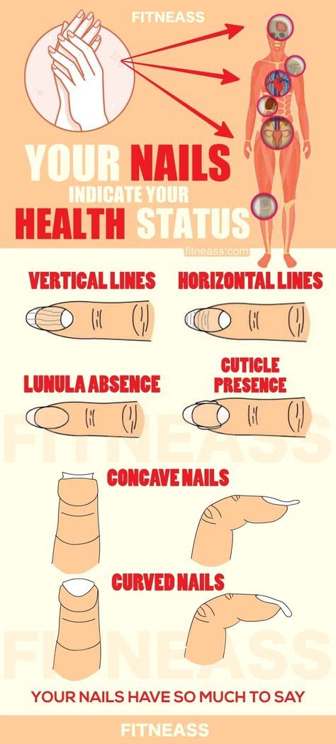 14 Nail Health Signs Ideas Nail Health Health Signs Nail Health Signs