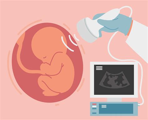 ultrasound scan of baby 2610654 Vector Art at Vecteezy