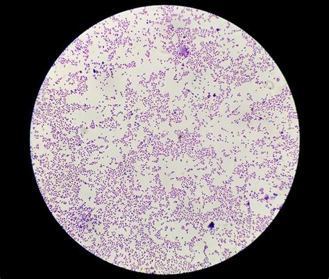 Staphylococcus Epidermidis Gram Stain