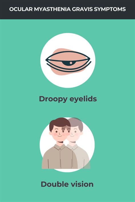 Ocular myasthenia gravis: Symptoms, causes, and treatment | Myasthenia ...