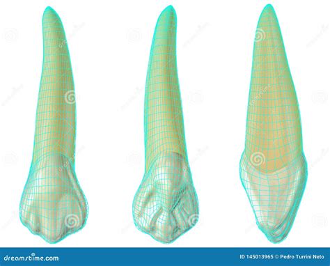 Maxillary Canine Tooth In The Vestibular Palatal And Lateral Views