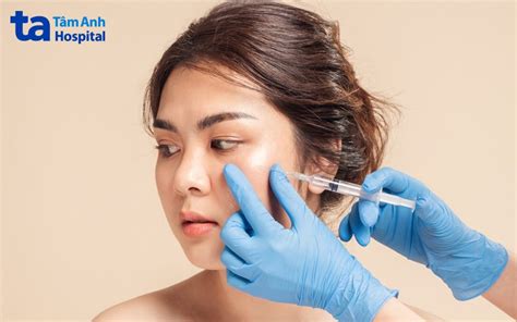 Tiêm filler có hại về sau không 7 tác dụng phụ thường gặp