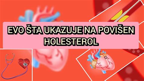 Ne postoje jasni simptomi povišenog holesterola koji je opasan po