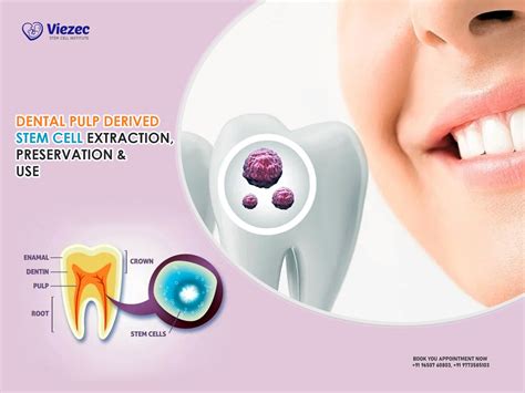 Dental Pulp Derived Stem Cell Extraction, Preservation & Use