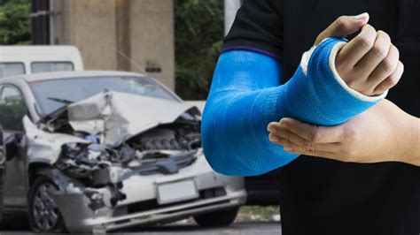 15 Common Car Crash Injuries – Forbes Advisor