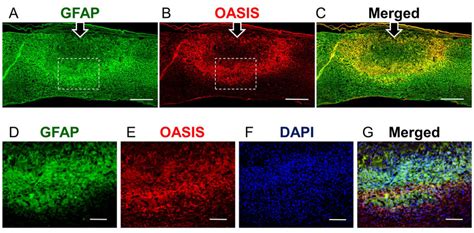 Immunohistochemistry Of Glial Fibrillary Acidic Protein GFAP And Old