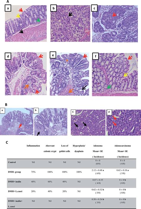 Microscopic Examination Of The Colon Tissues A H E Staining Of The