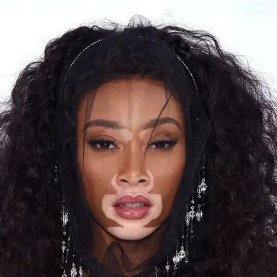 what is winnie harlow's net worth