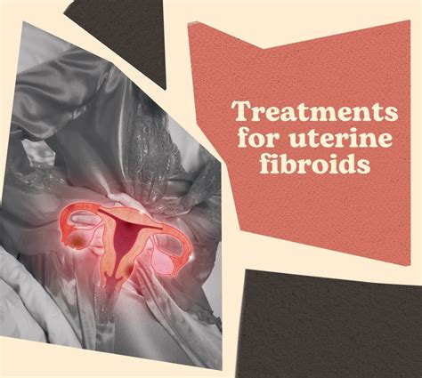 Uterine Fibroids: Causes, Symptoms, and Treatment - A Comprehensive ...