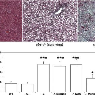 Histological And Ultrastructural Analysis Of Cbs Mouse Liver