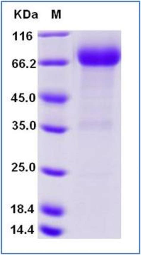 Sino Biological KIR2DL3 Protein Human Recombinant ECD hFc Tag 50µg