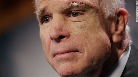 John Mccain On His Cancer Its Very Very Serious Cnnpolitics