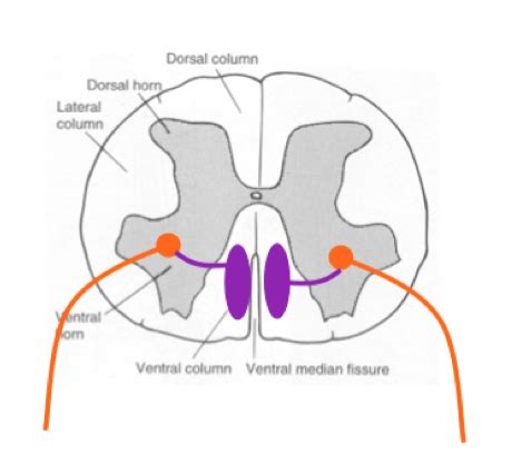 Myelopathies In Largies Flashcards Quizlet