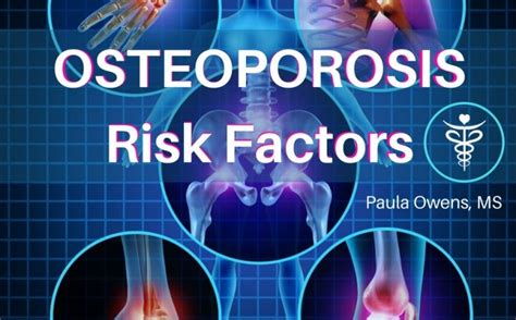 Bone Loss and Osteoporosis Risk Factors - Paula Owens, MS