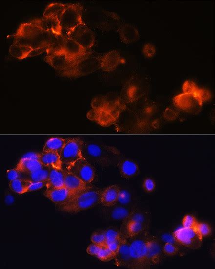 Glypican 3 Recombinant Monoclonal Antibody Arc0675 Ma5 35154