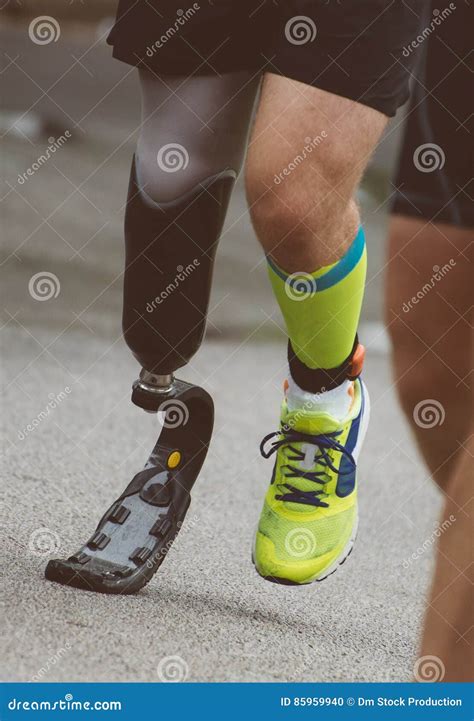 Man Running With Prosthetic Leg. Stock Photo | CartoonDealer.com #85960020