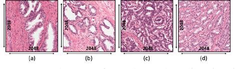 Figure 3 From Artificial Intelligence Techniques For Prostate Cancer