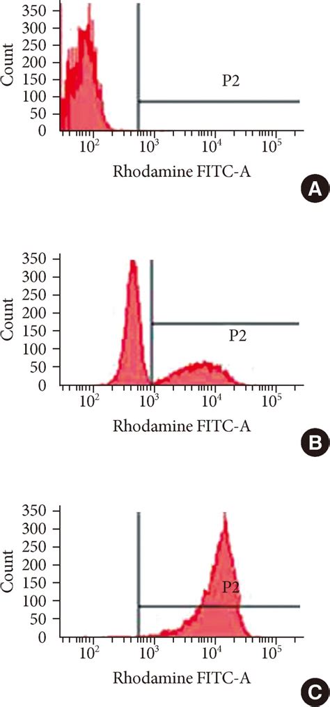 Histograms Of The Dihydrorhodamine Dhr Assay Of Granulocytes From The