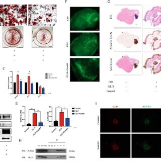 Gli1 Accelerates The Osteogenic Differentiation Of VICs A Alizarin