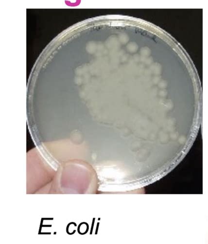 Microbiology Lab Practical Flashcards Quizlet