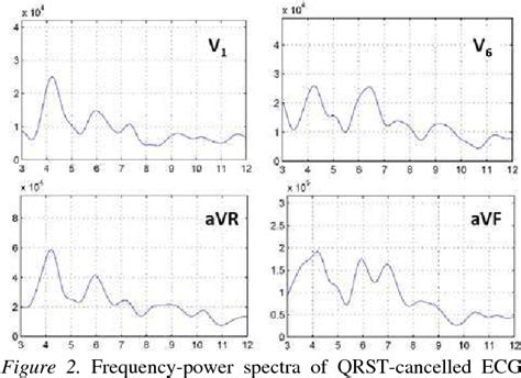 Figure From Non Invasive Estimates Of Left Atrial Activation In A