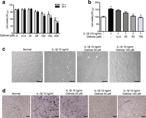 Osthole alleviates IL 1β induced proliferation and migration in SW982