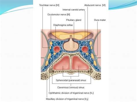 Sphenoid Sinus And Optic Nerve Ppt