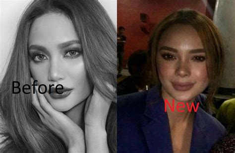 Netizens Notice The New Nose Of Arci Munoz Attracttour