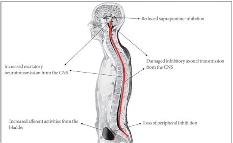 Figure 1 From Pathophysiology Of Overactive Bladder And Pharmacologic