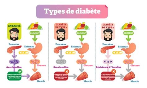 Apprenez à Réduire Votre Risque De Souffrir Du Diabète De Type 2