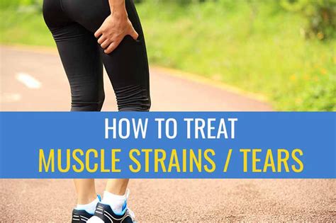 How To Treat A Muscle Strain Tear Sports Injury Physio