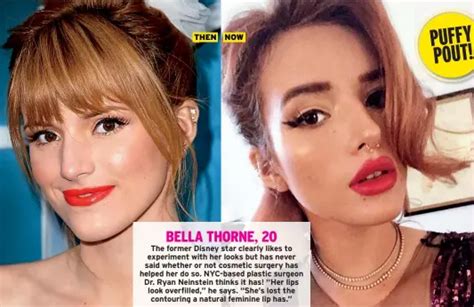 Bella Thorne Nose Job Before And After