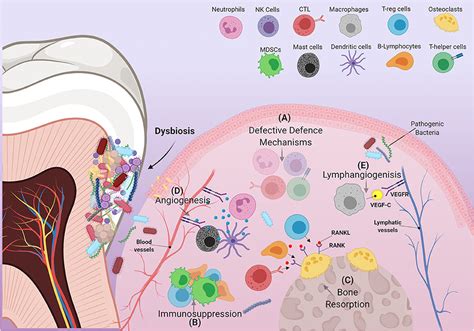 Periodontitis Schematic