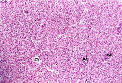 Normal histological criteria of the hepatic cords, hepatocytes, central ...