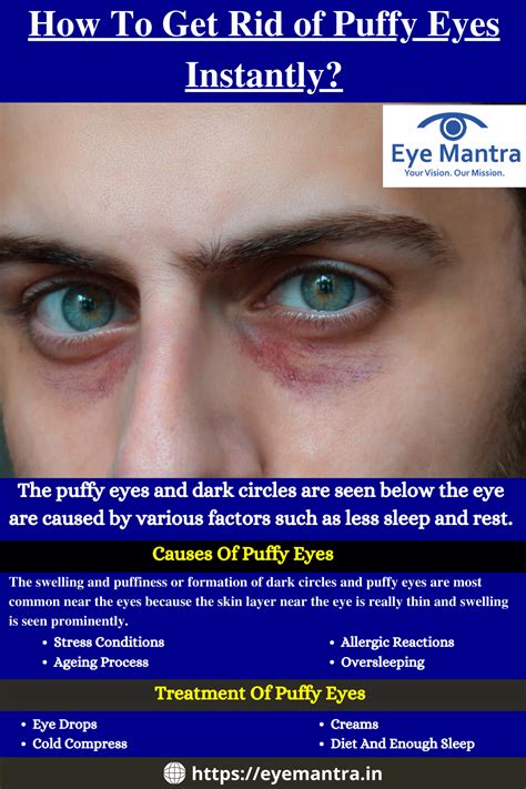 5 Causes Of Swollen Eyelids Artofit